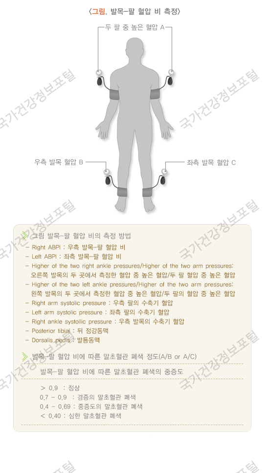 발목-팔 혈압 비 측정