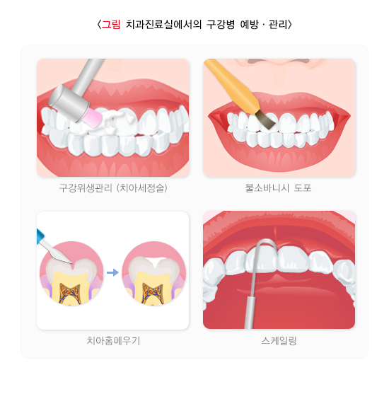 치과진료실에서의 구강병 예방∙관리